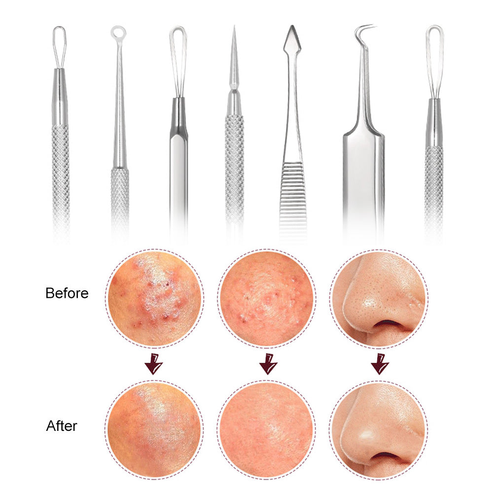 7Pcs Blackhead Remover Tool Kit